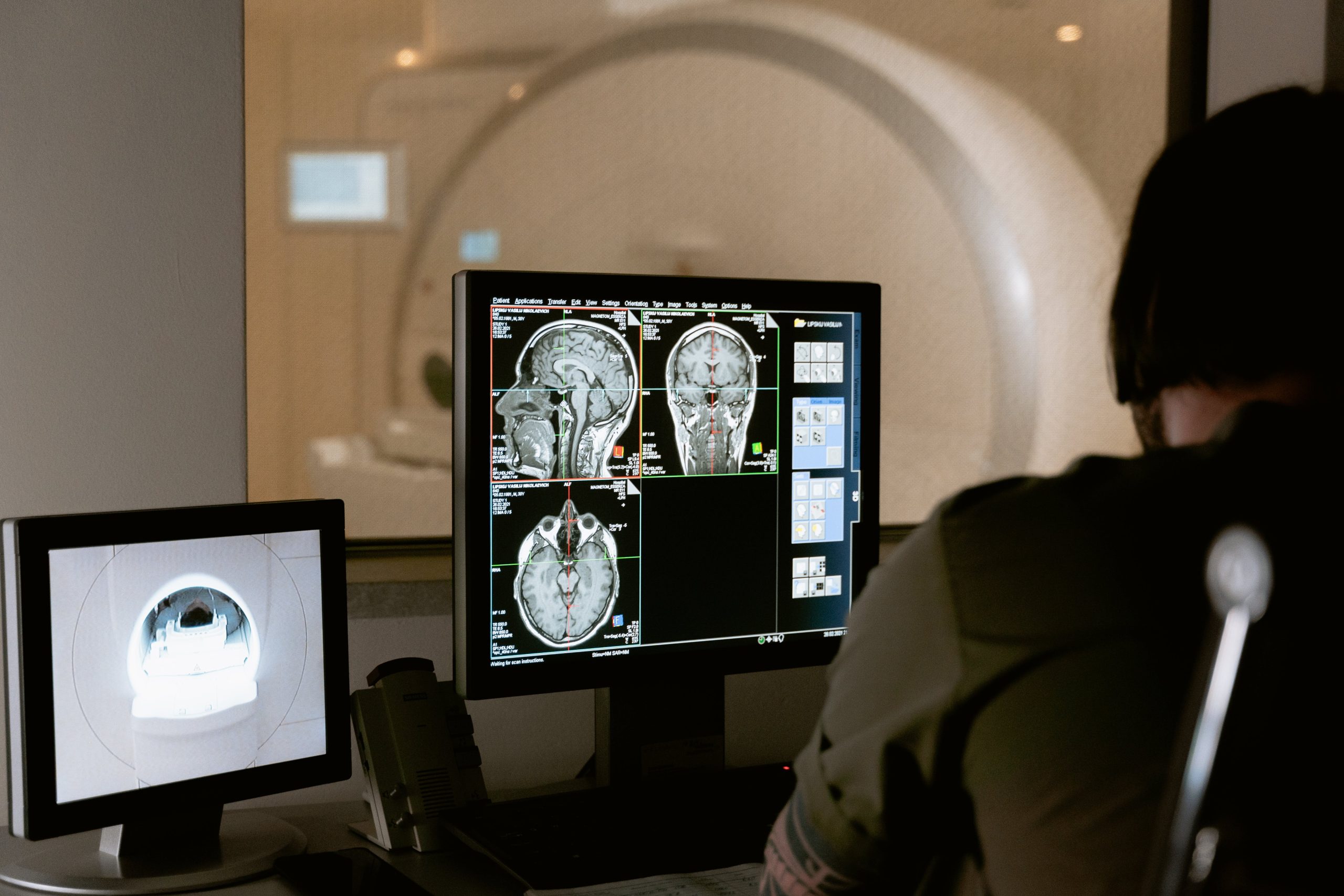 Radiation Oncology specialty doctor looks at scans in hospital